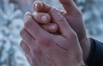 Аллергия на мороз: что важно знать зимой