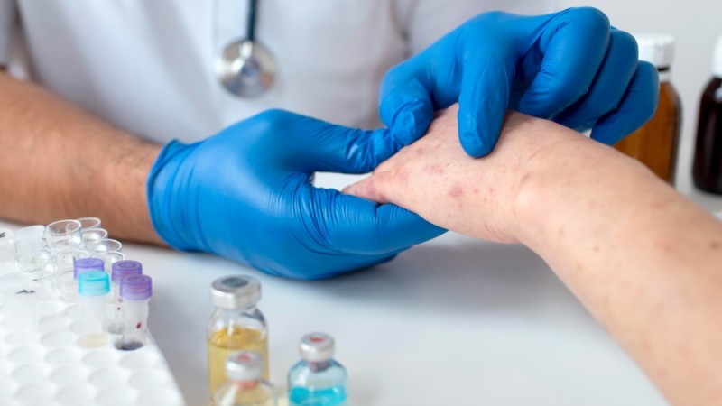 В Алматы зафиксирован рост заболеваемости корью