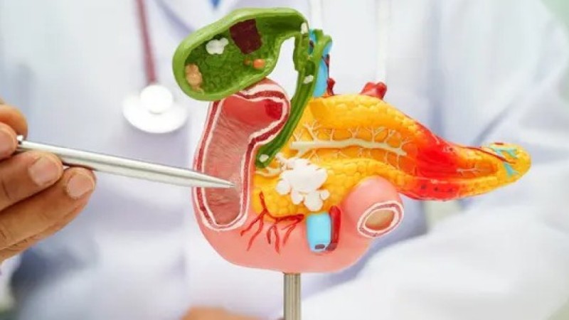 Ежегодно умирают 10 200 человек: привычки, повышающие риск «тихого» рака поджелудочной железы