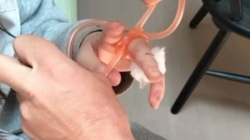 16-летнюю девушку укусила змея на озере Кольсай